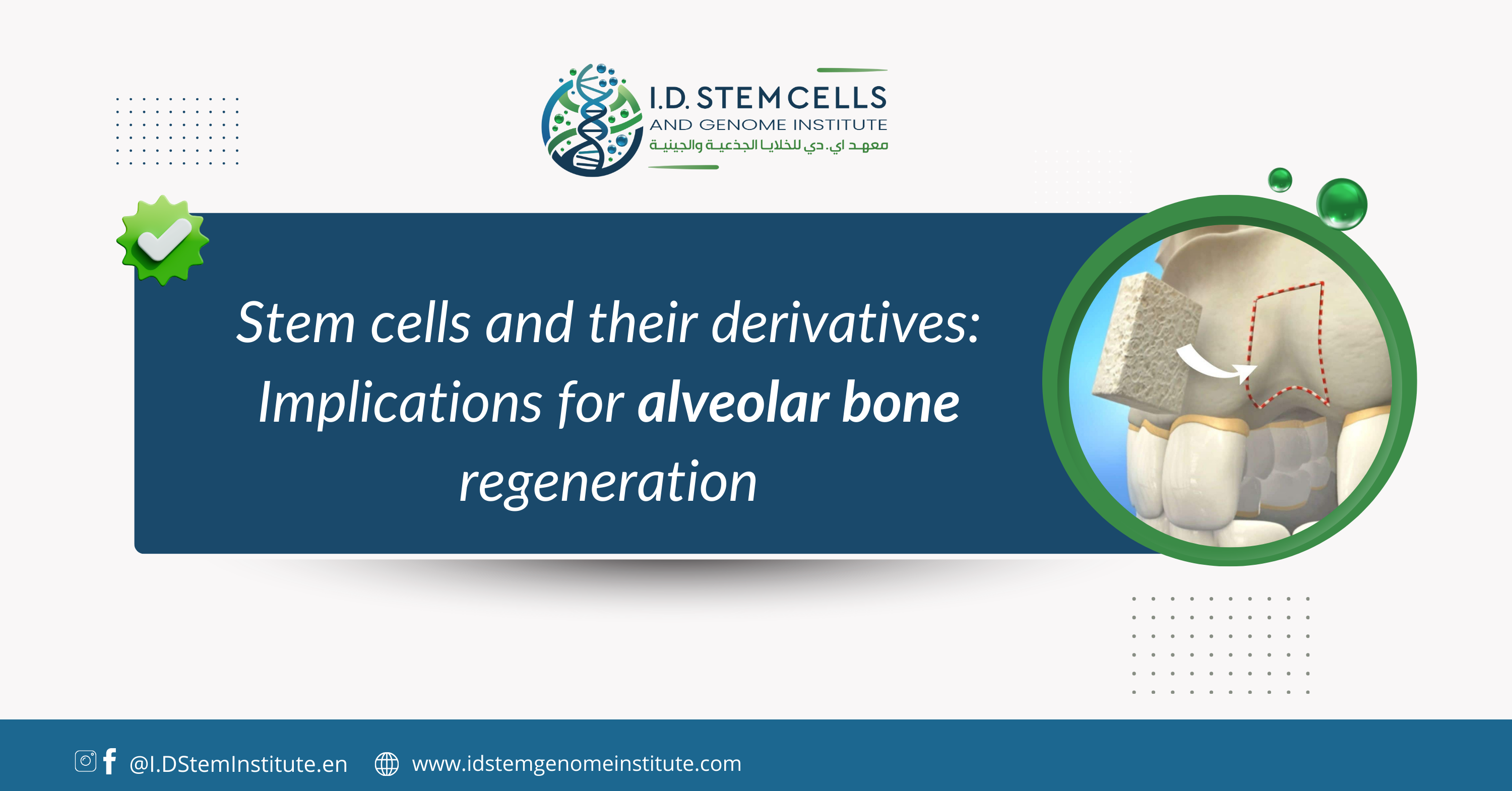 Stem cells and their derivatives: Implications for alveolar bone regeneration