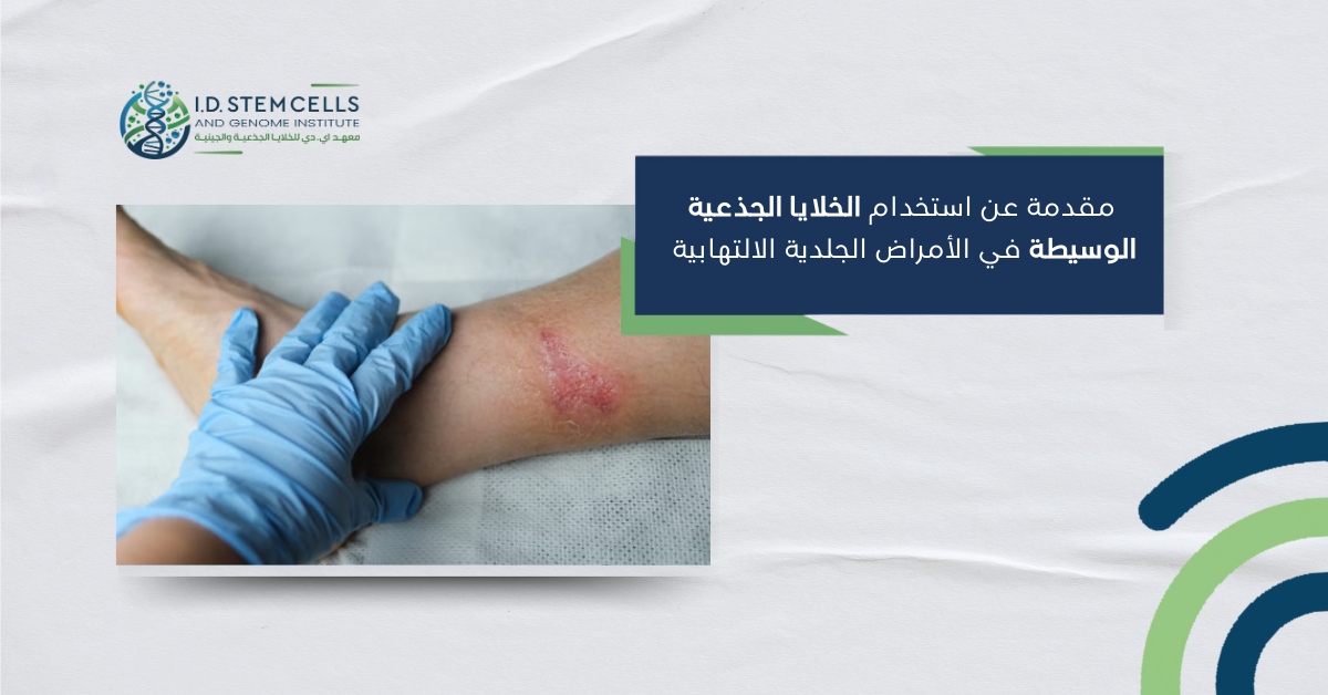 مقدمة عن استخدام الخلايا الجذعية الوسيطة في الأمراض الجلدية الالتهابية