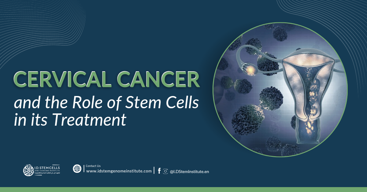 Cervical Cancer and the Role of Stem Cells in its Treatment