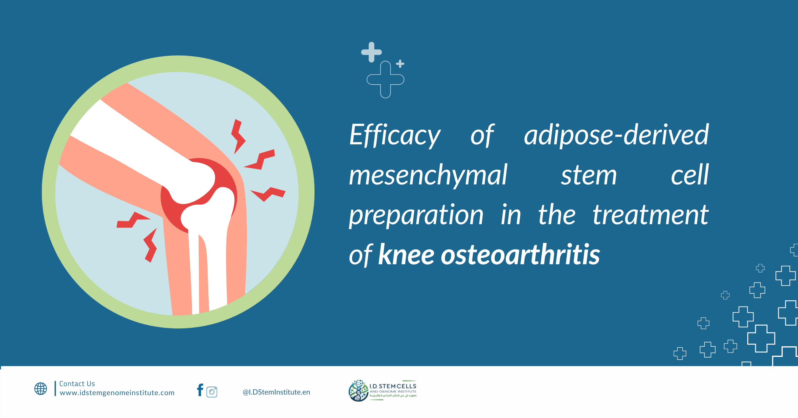 Efficacy of adipose-derived mesenchymal stem cell preparation in the treatment of knee osteoarthritis