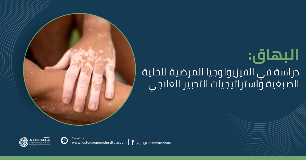 البهاق: دراسة في الفيزيولوجيا المرضية للخلية الصبغية واستراتيجيات التدبير العلاجي