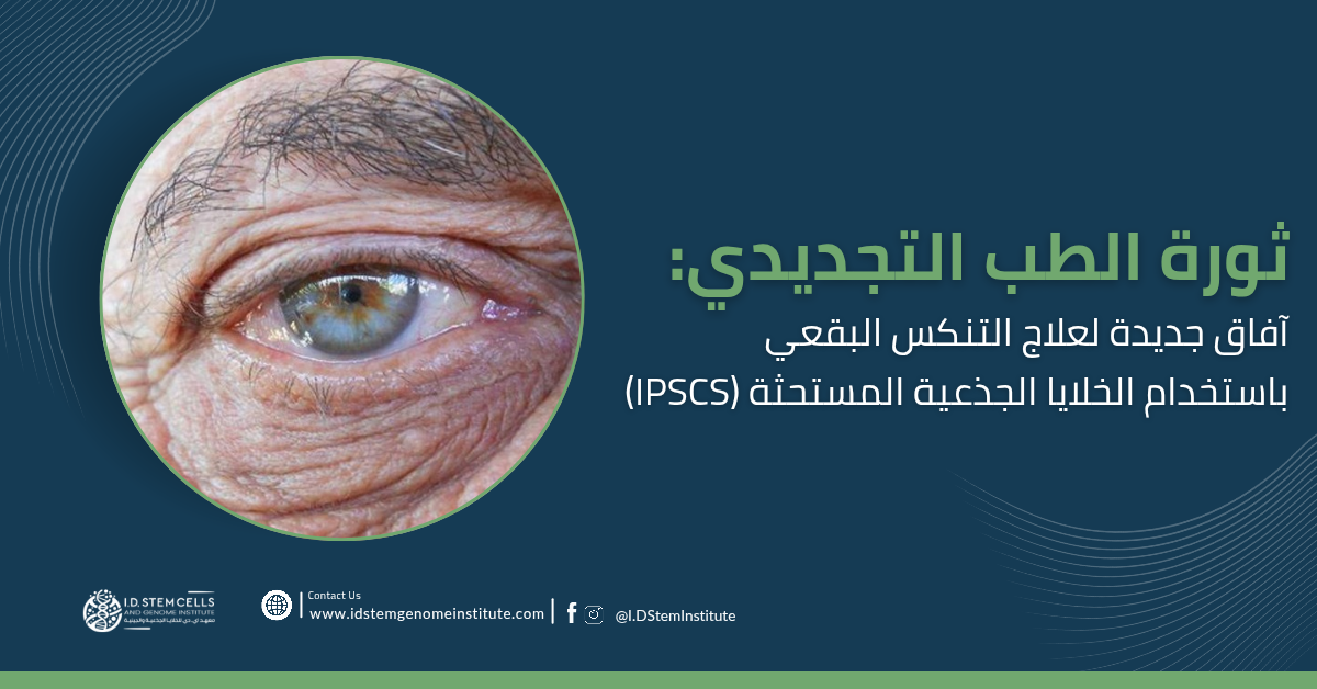 ثورة الطب التجديدي: آفاق جديدة لعلاج التنكس البقعي باستخدام الخلايا الجذعية المستحثة (iPSCs)